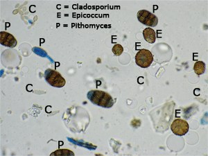 Fungal spore identification course